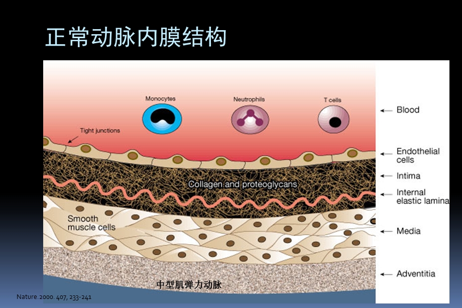 从动脉粥样硬化形成机制看调脂治疗策略.ppt_第3页