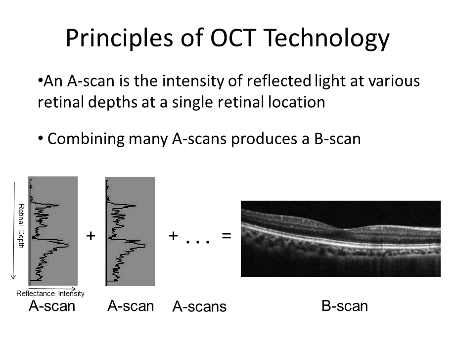 Time Domain OCTPredpharma.ppt_第3页