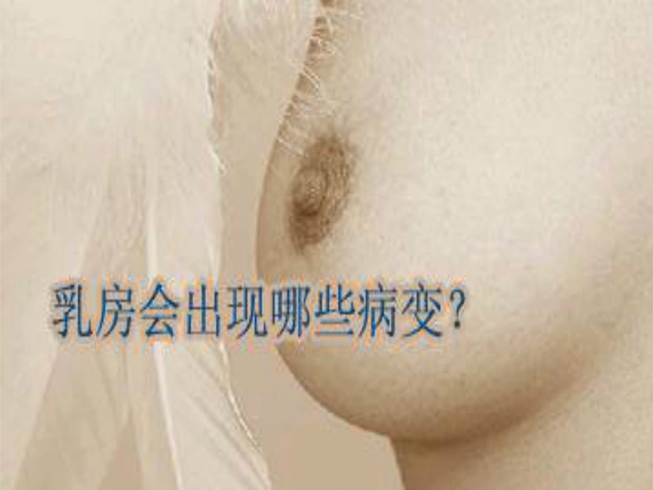 [精彩]9第九章 乳腺炎防备医学医药卫生专业资料.ppt_第2页