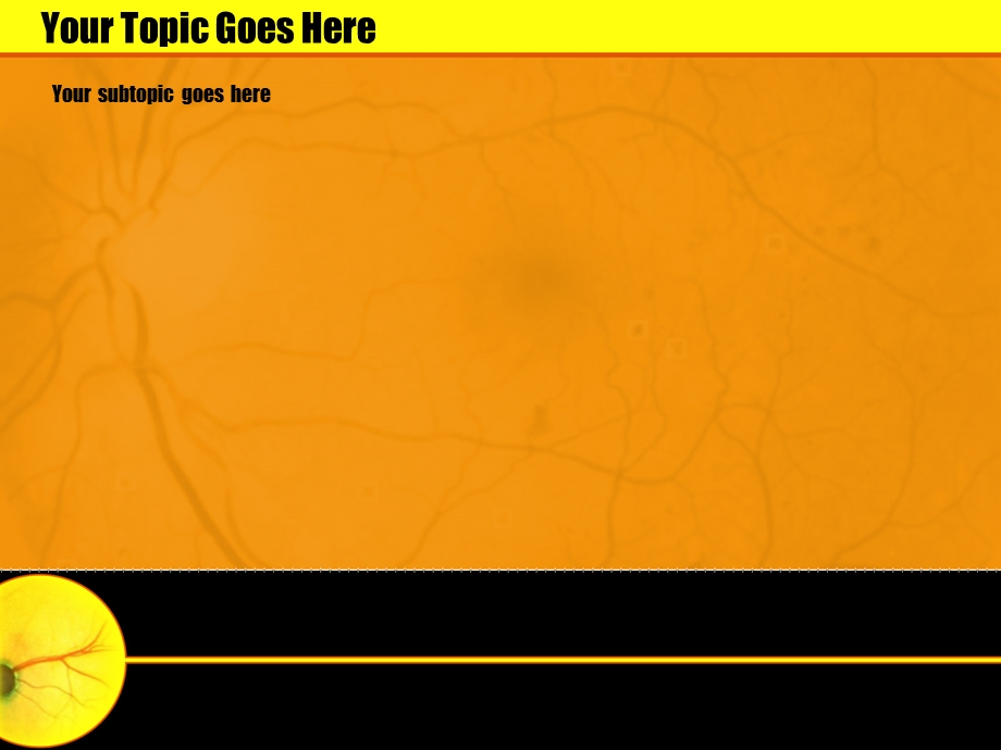 视网膜橙色风格医学PPT ppt模板.ppt_第2页