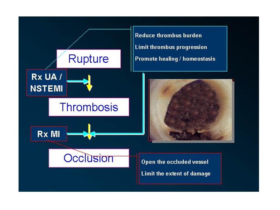 从最新研究进展看低分子肝素与肝素的区别(1).ppt_第3页