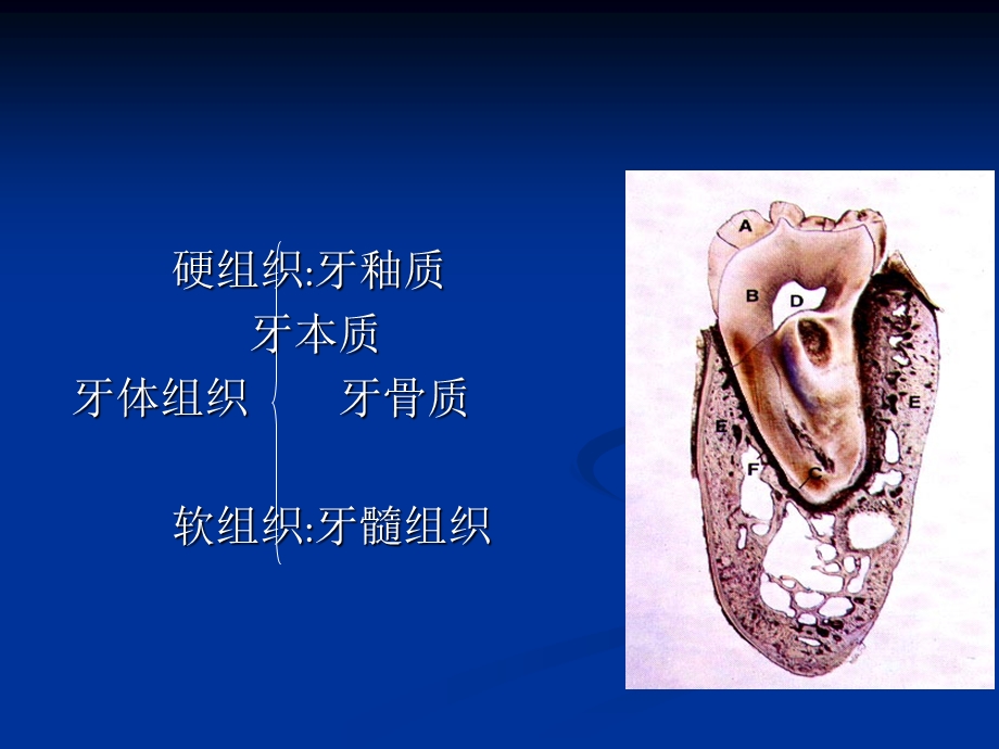 第四章 牙体牙髓病.ppt_第2页