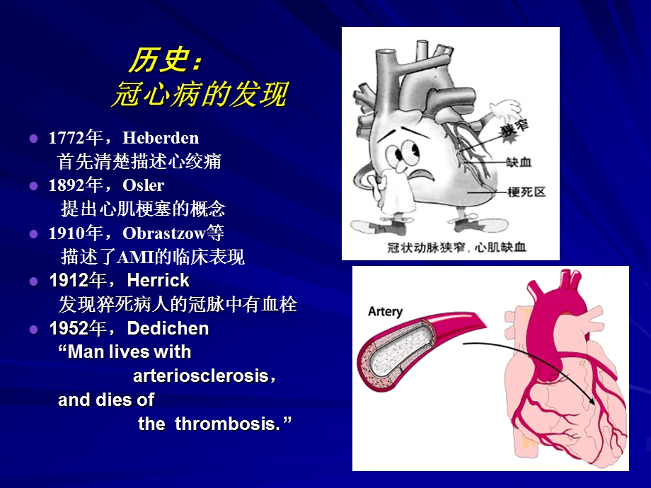 冠心病的介入治疗(1).ppt_第2页