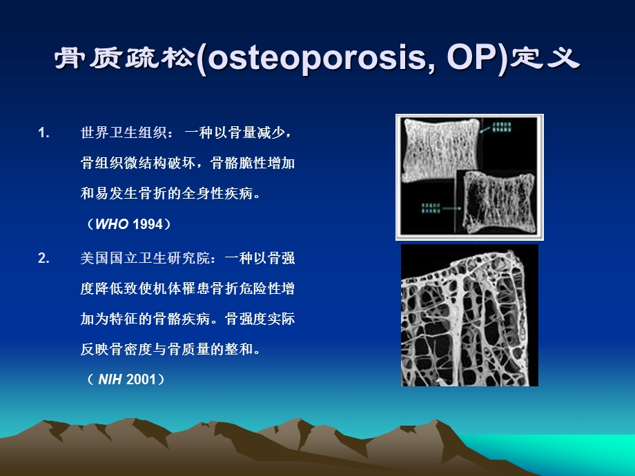 2014原发性骨质疏松症诊治指南张红.ppt_第3页