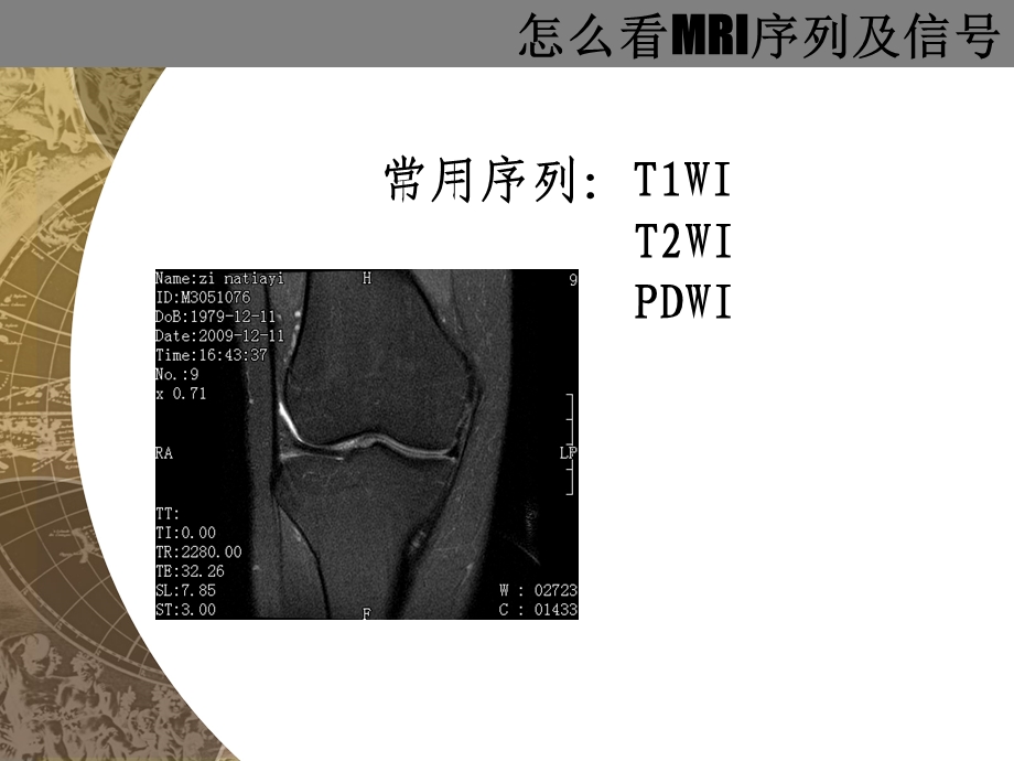 怎么看MRI片.ppt_第2页