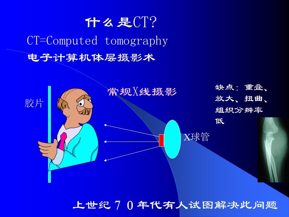 10版教材孟修改稿-CT总论.ppt_第2页