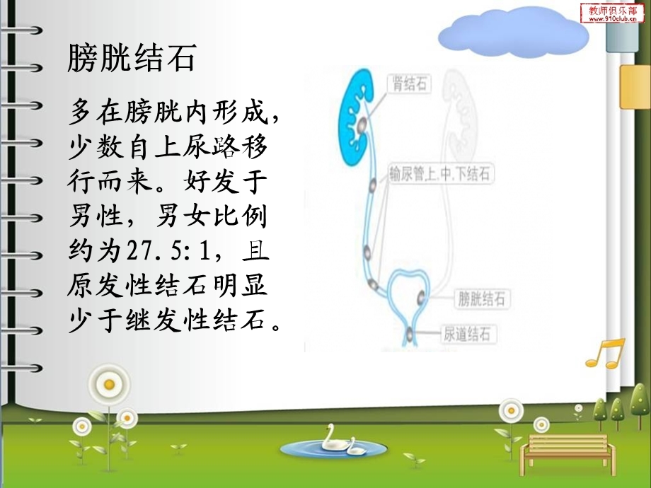 膀胱结石.ppt_第3页