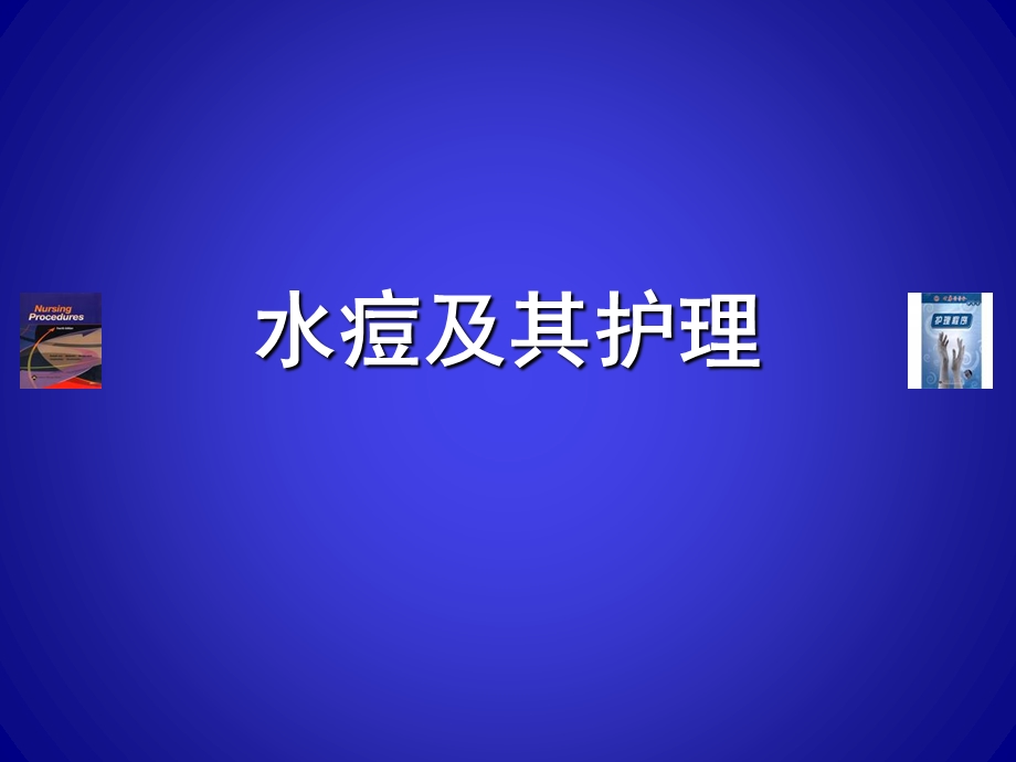 水痘及其护理.ppt_第1页