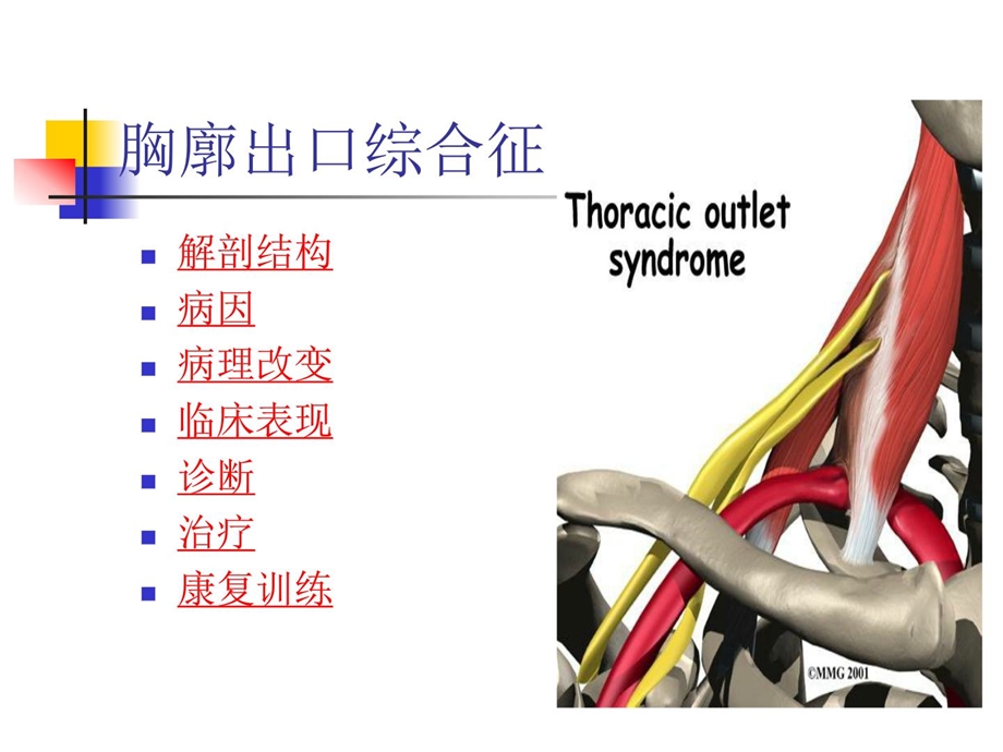 [指南]胸廓出口综合征.ppt_第3页