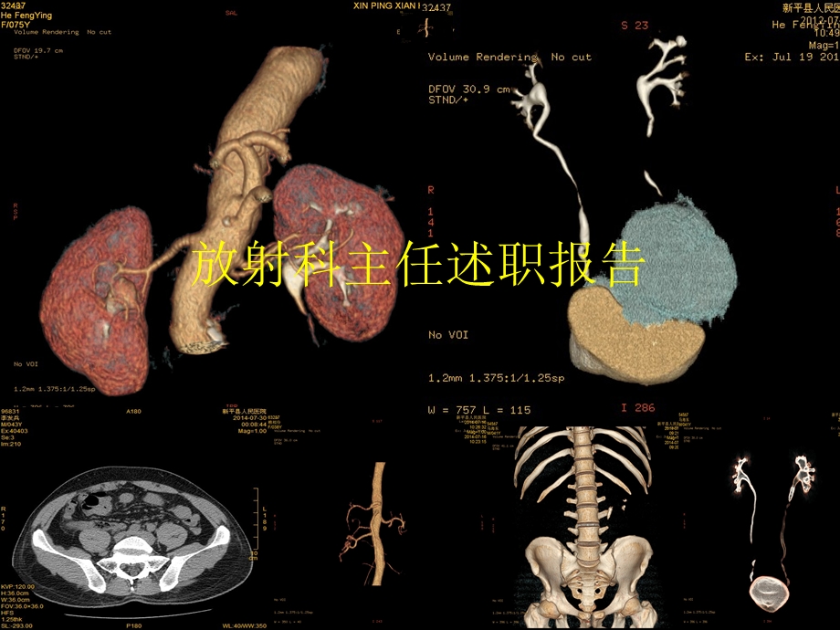 医院放射科主任述职报告(1).ppt_第1页