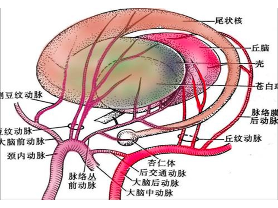 急性脑血管疾病的西医规范治疗和中医优势思考.ppt_第3页