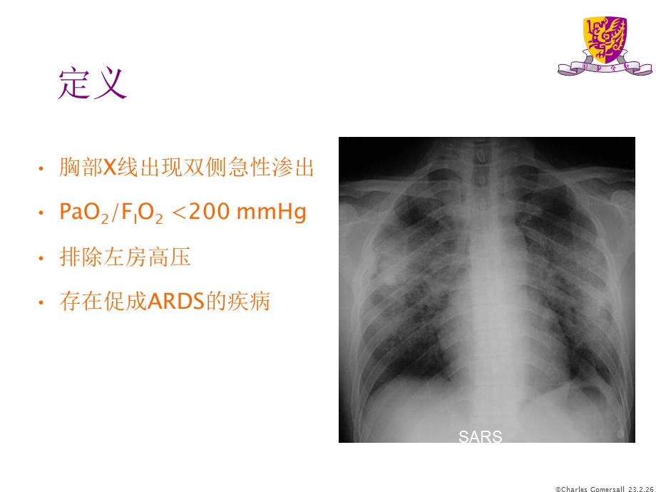 ards患者的机械通气.ppt_第3页