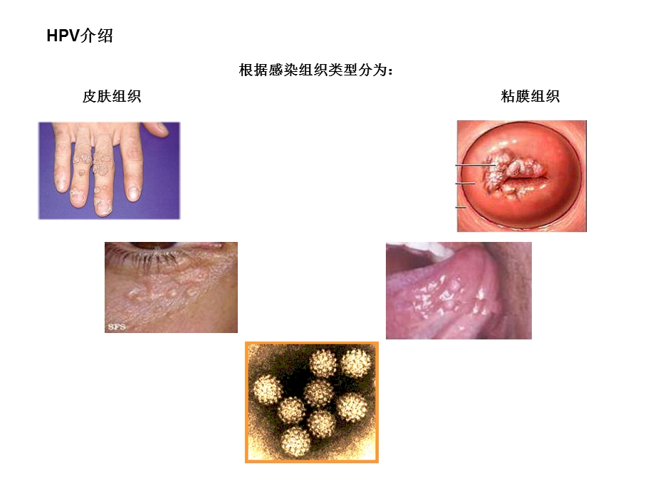 HPV_-DNA检测现状及2012最新国际宫颈癌筛查指南.ppt_第3页