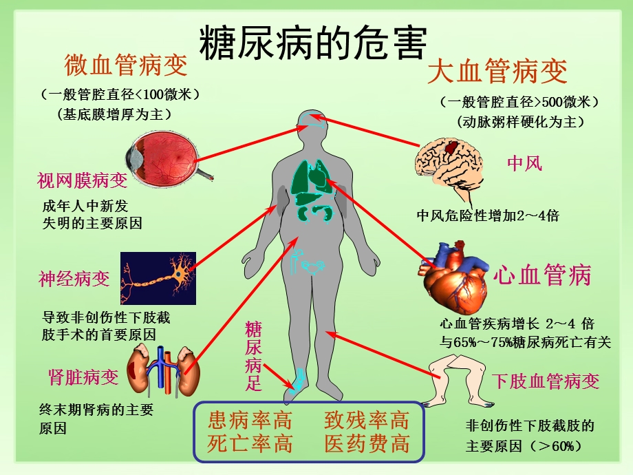 糖尿病肾病的诊治.ppt_第2页