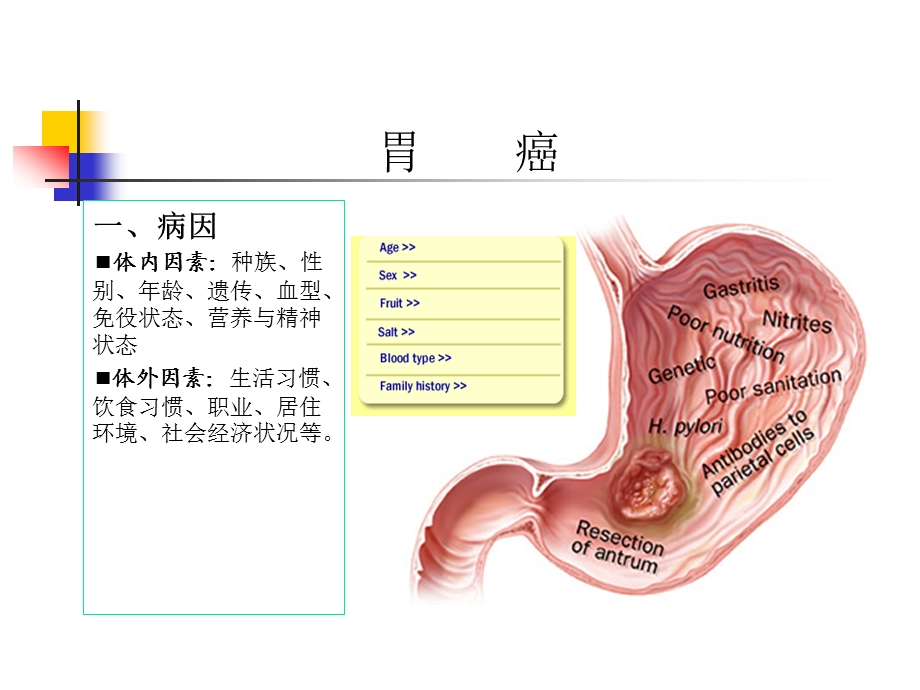 胃癌.ppt.ppt_第3页