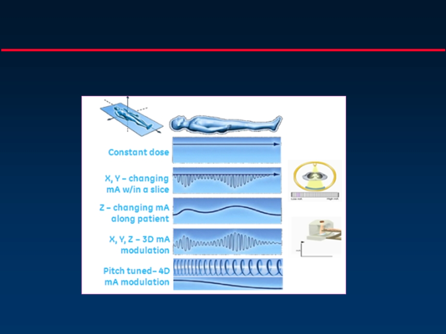 MR机器的技术改革.ppt_第3页