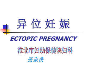 异位妊娠.ppt(1).ppt