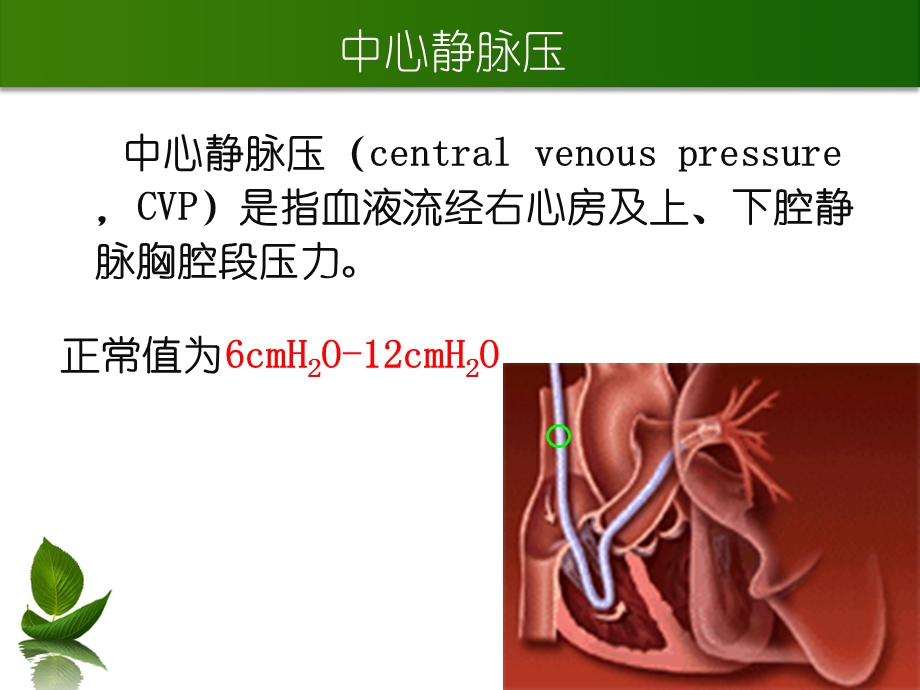 心静脉压的测定及中心静脉导管护理.ppt_第3页