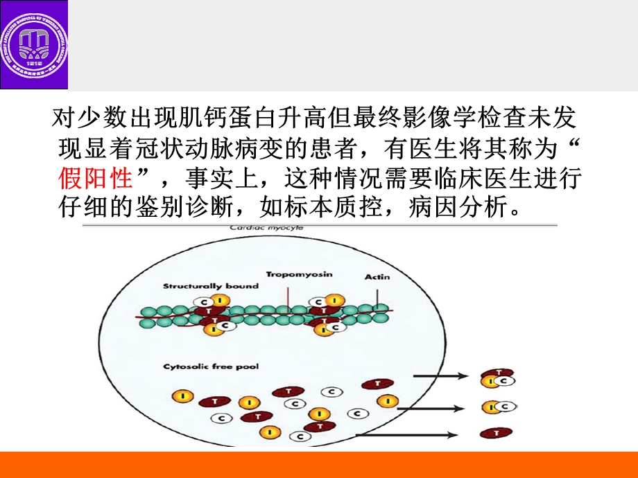 肌钙蛋白升高的鉴别诊断.ppt_第3页