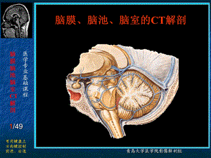 脑膜、脑池、脑室的CT解剖.ppt