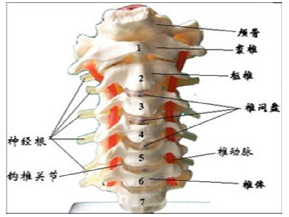 颈椎骨折病人的护理.ppt_第3页