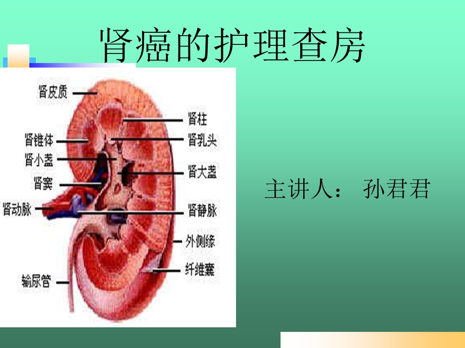 肾癌的护理查房.ppt_第1页