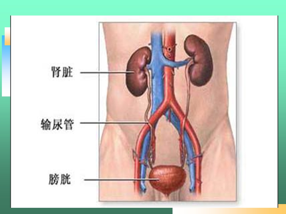 肾癌的护理查房.ppt_第2页