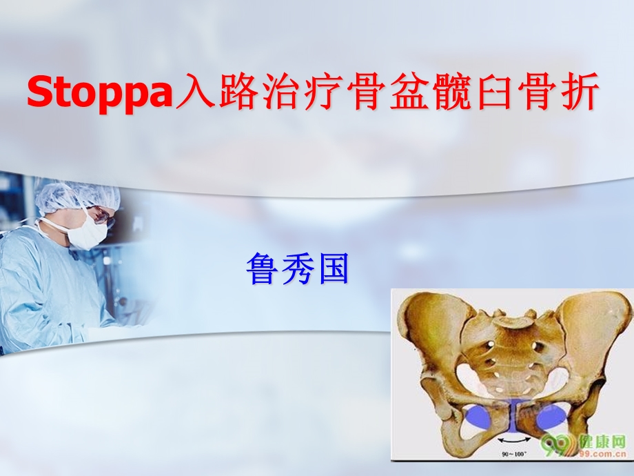 stoppa技术.ppt_第1页