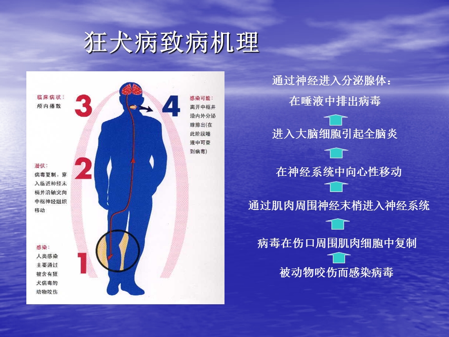 医院狂犬病暴露后处置(1).ppt_第3页