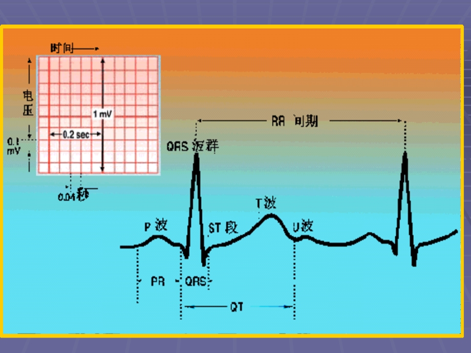 医院心电图基础知识医学幻灯片.ppt_第3页