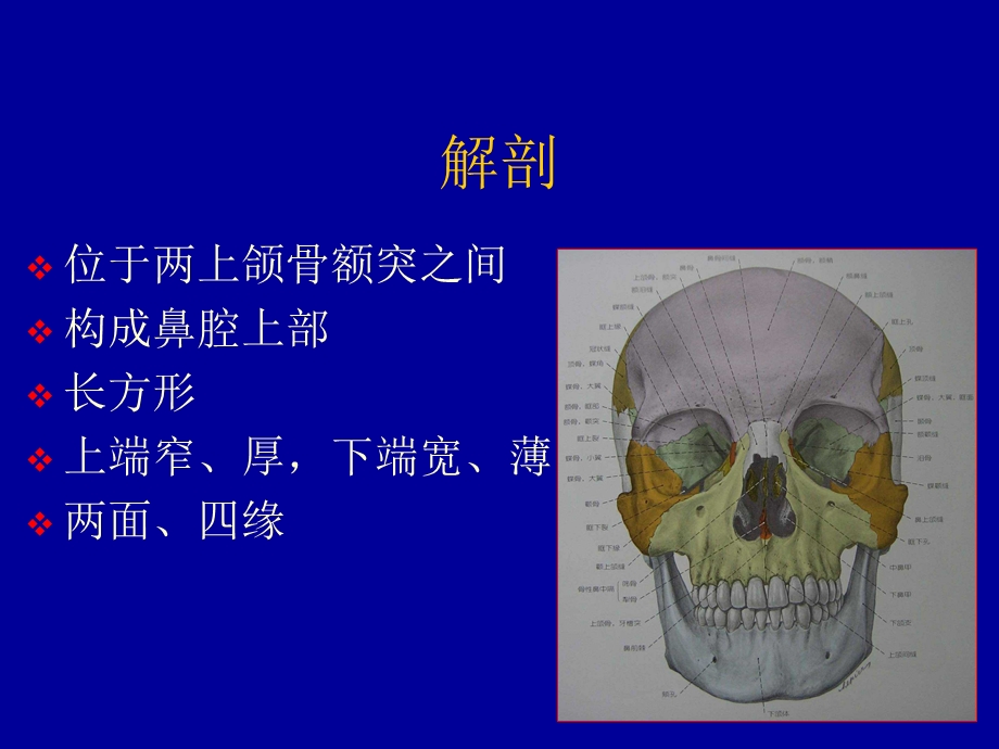 鼻骨骨折影像学诊断.ppt_第2页