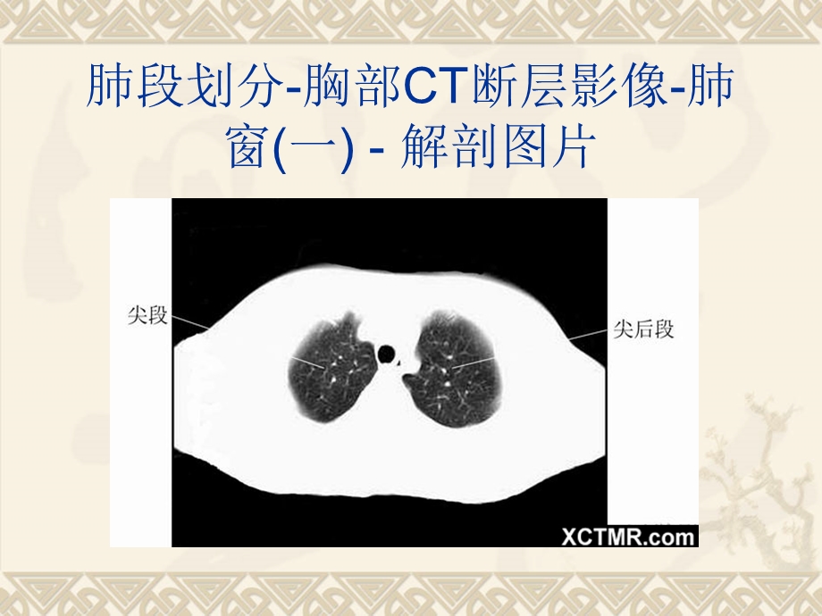 上腹和盆腔CT详细实用图解.ppt.ppt_第3页