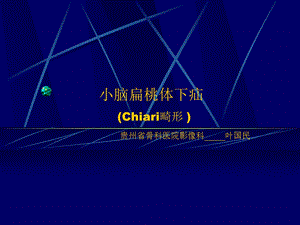 Chiari畸形.ppt