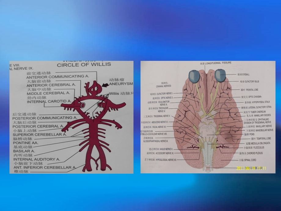 【全套医学课件100p】脑梗死的诊断与治疗.ppt_第3页