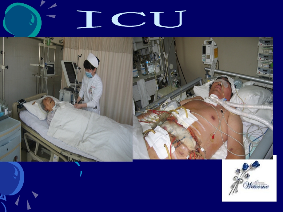 ICU谵妄病人的评估与实施.ppt_第3页