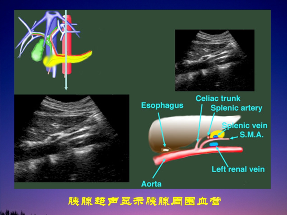 磁共振胰胆管造影(MRCP).ppt_第3页