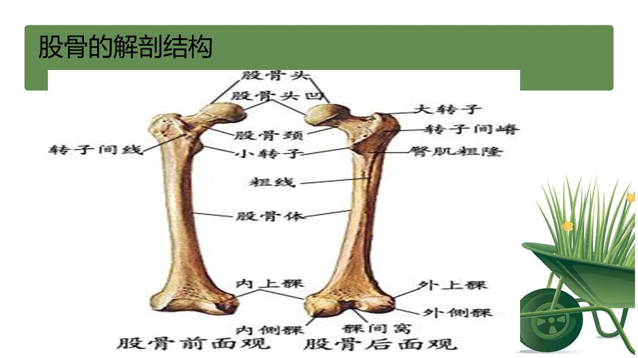 股骨颈骨折护理(1).ppt_第3页