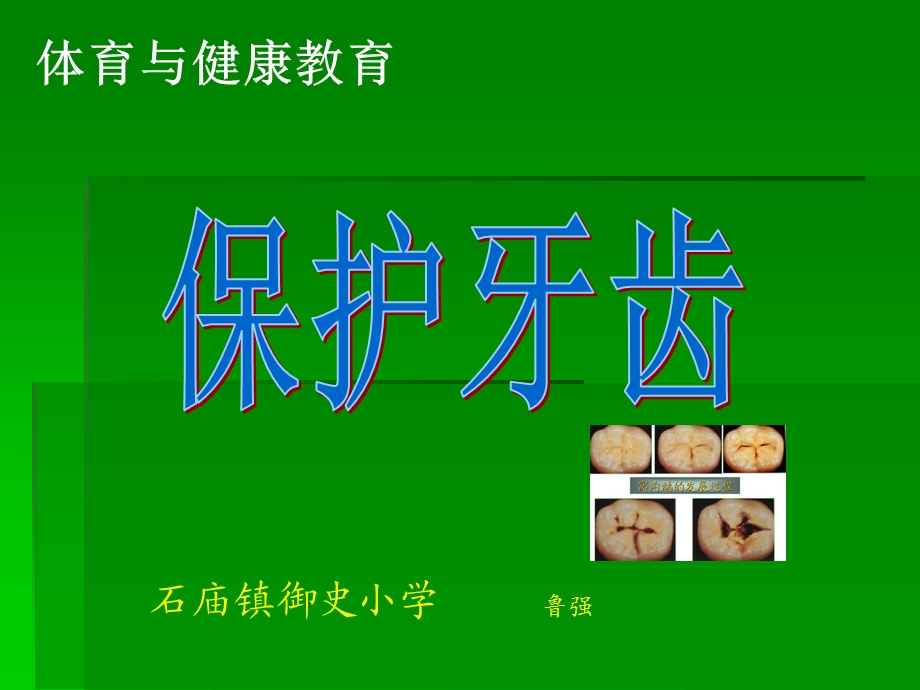 小学体育与健康《保护牙齿》课件1.ppt_第2页