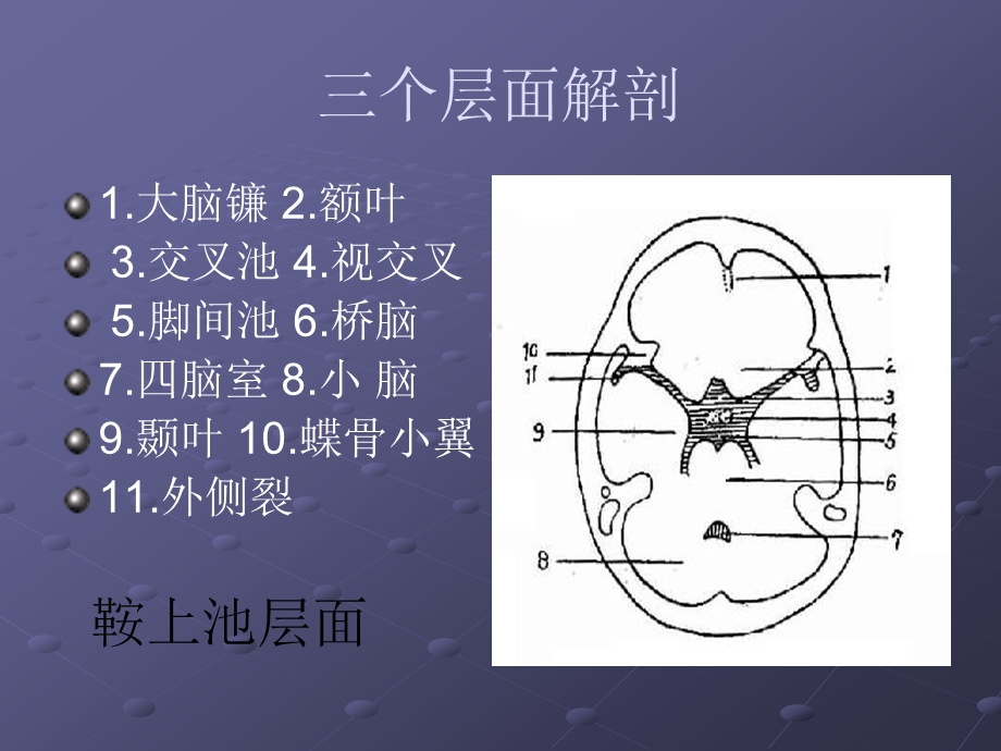 颅脑CT层面解剖.ppt_第2页