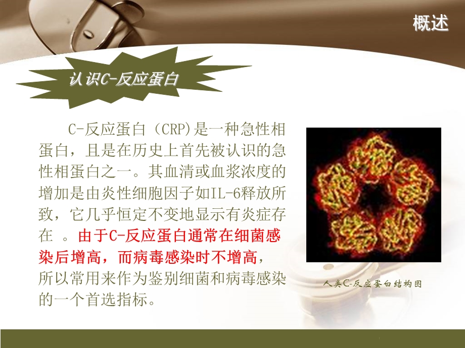 CRP临床意义.ppt_第3页