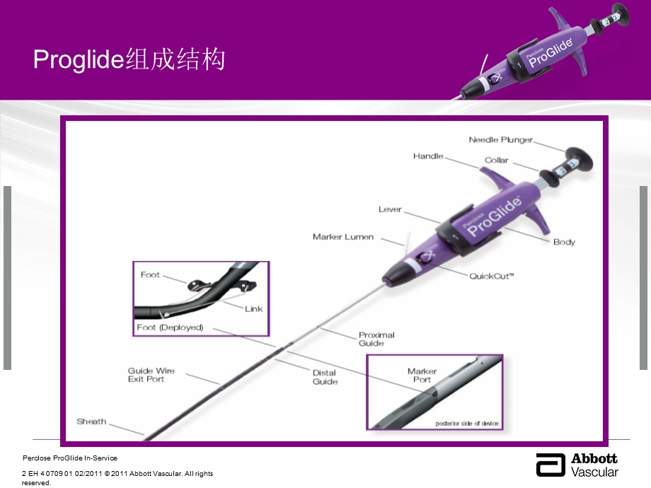 2_血管闭合器在大支架缝合中的应用(2).ppt_第3页