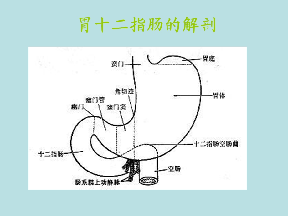 消化道溃疡的护理.ppt_第3页