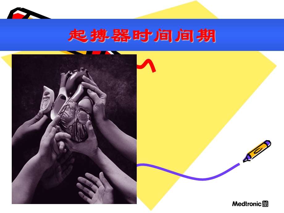 心脏起搏器心电图.ppt_第3页