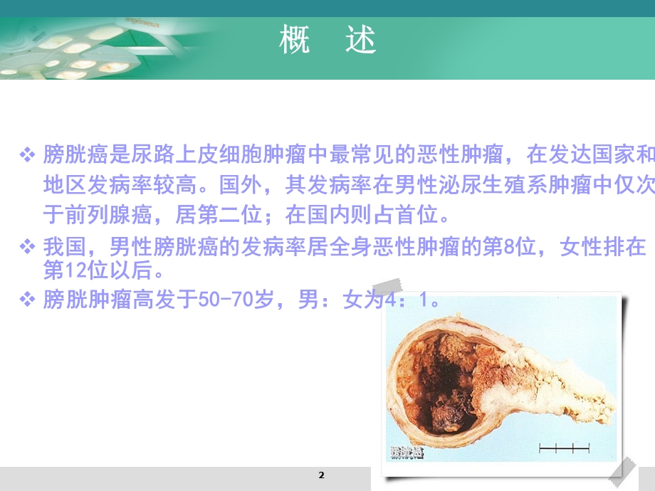 膀胱肿瘤病人的护理.ppt_第2页