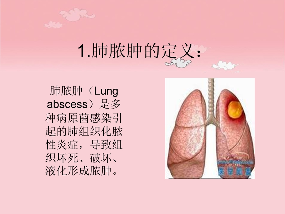 肺脓肿疾病病人的护理查房.ppt_第2页