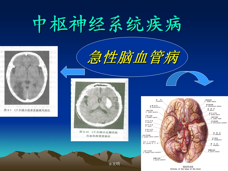 36急性脑血管病(简).ppt_第1页