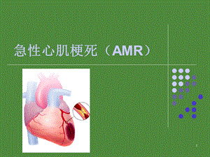 急性心肌梗死护理查房(1).ppt