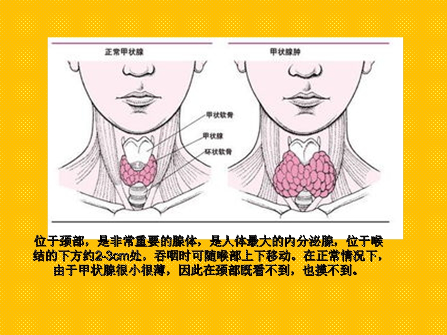 妊娠合并甲状腺疾病讲义.ppt_第3页