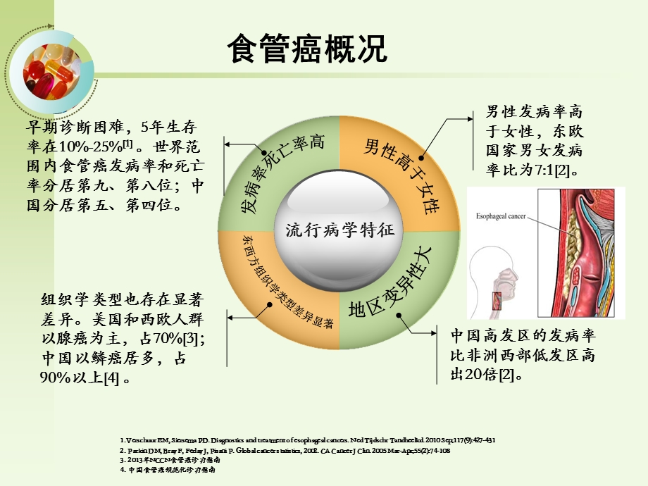 食管癌综合治疗.ppt_第3页