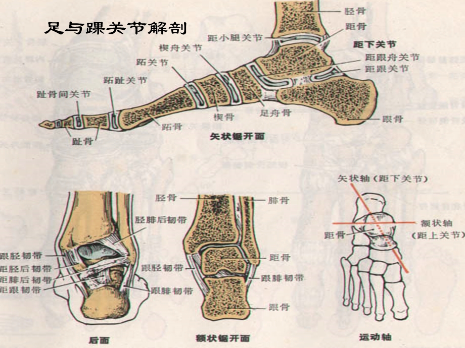 骨科个案-踝关节骨折病人护理-医大.ppt_第3页